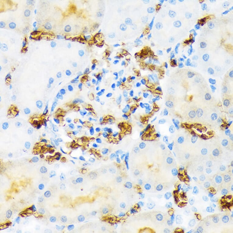 Immunohistochemistry - Anti-Hemoglobin subunit alpha Antibody [ARC1510] (A307978) - Antibodies.com