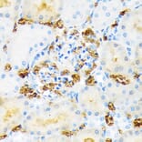 Immunohistochemistry - Anti-Hemoglobin subunit alpha Antibody [ARC1510] (A307978) - Antibodies.com