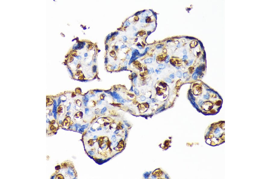 Immunohistochemistry - Anti-Hemoglobin subunit alpha Antibody [ARC1510] (A307978) - Antibodies.com