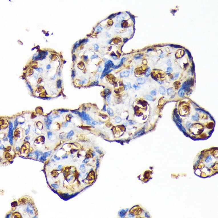 Immunohistochemistry - Anti-Hemoglobin subunit alpha Antibody [ARC1510] (A307978) - Antibodies.com