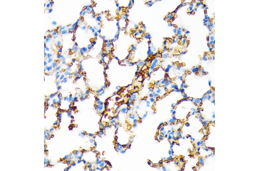 Immunohistochemistry - Anti-Hemoglobin subunit alpha Antibody [ARC1510] (A307978) - Antibodies.com