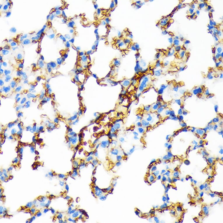 Immunohistochemistry - Anti-Hemoglobin subunit alpha Antibody [ARC1510] (A307978) - Antibodies.com