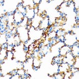 Immunohistochemistry - Anti-Hemoglobin subunit alpha Antibody [ARC1510] (A307978) - Antibodies.com