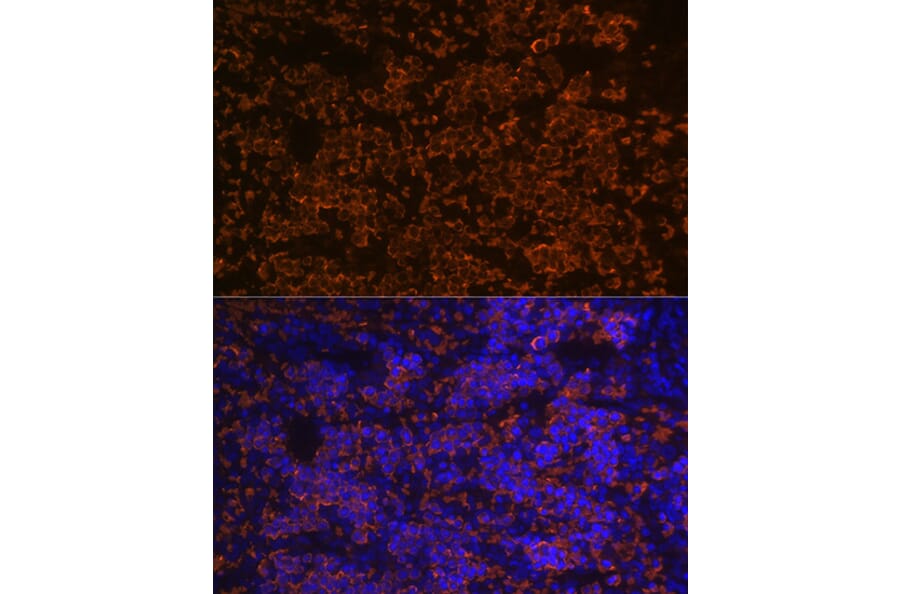 Immunofluorescence - Anti-Hemoglobin subunit alpha Antibody [ARC1510] (A307978) - Antibodies.com