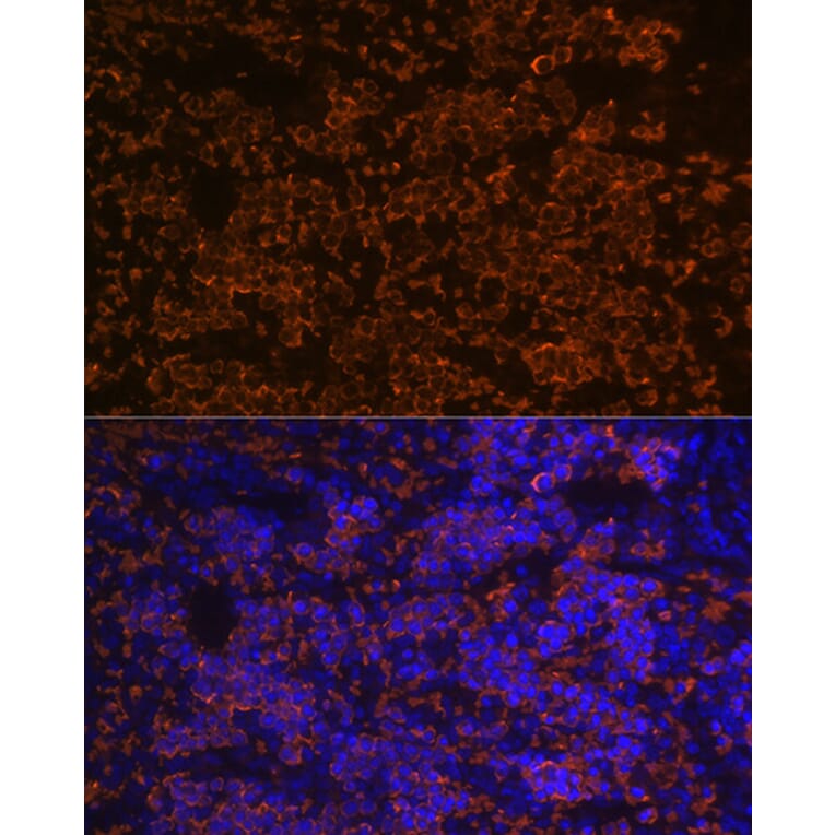 Immunofluorescence - Anti-Hemoglobin subunit alpha Antibody [ARC1510] (A307978) - Antibodies.com