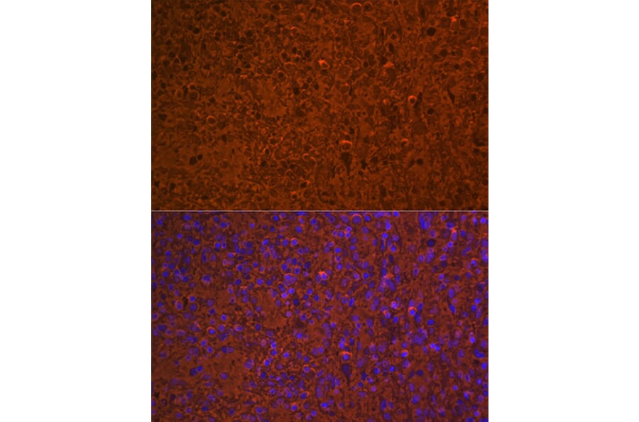 Immunofluorescence - Anti-Hemoglobin subunit alpha Antibody [ARC1510] (A307978) - Antibodies.com