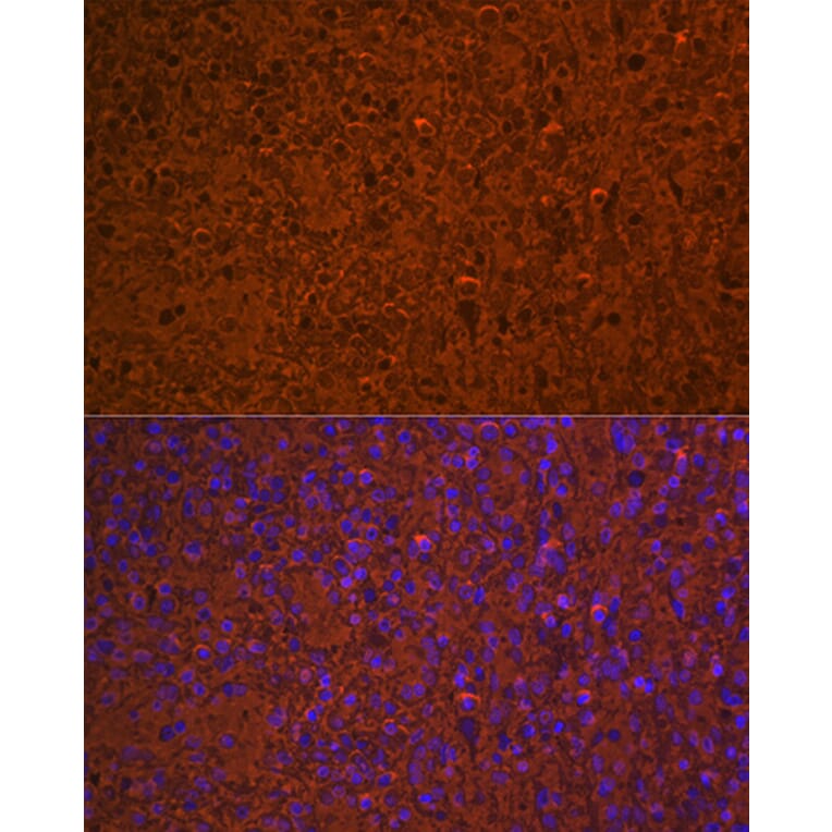 Immunofluorescence - Anti-Hemoglobin subunit alpha Antibody [ARC1510] (A307978) - Antibodies.com