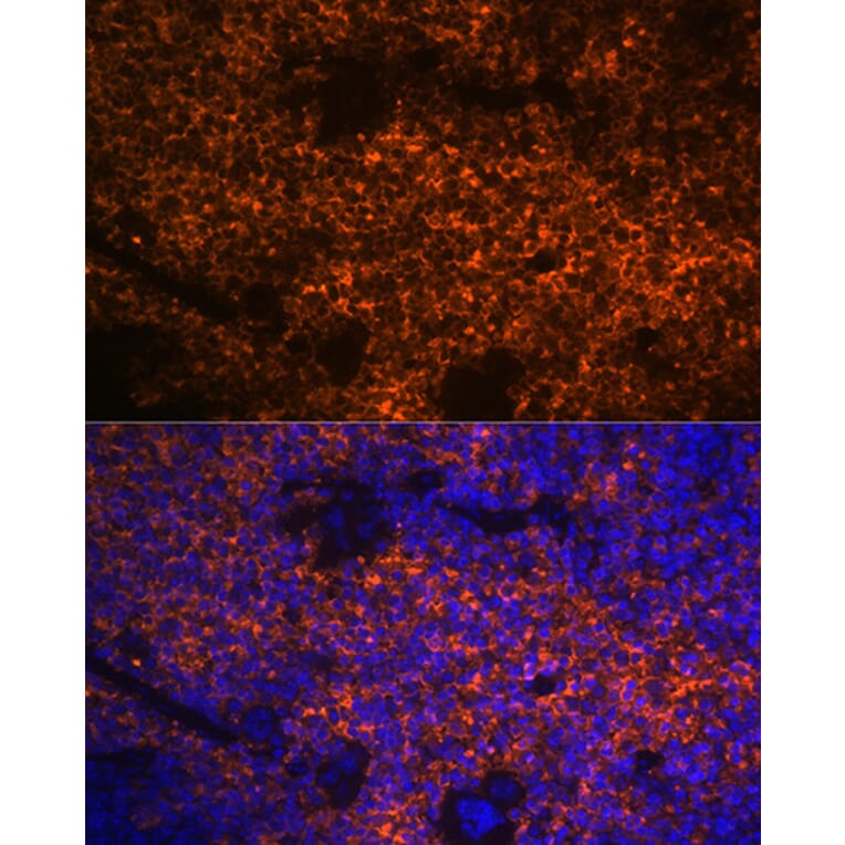 Immunofluorescence - Anti-Hemoglobin subunit alpha Antibody [ARC1510] (A307978) - Antibodies.com