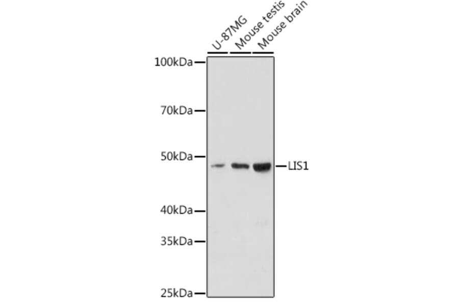 Western Blot - Anti-LIS1 Antibody [ARC2075] (A307979) - Antibodies.com