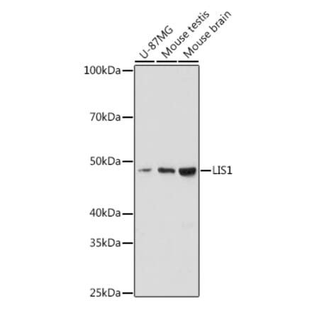 Western Blot - Anti-LIS1 Antibody [ARC2075] (A307979) - Antibodies.com