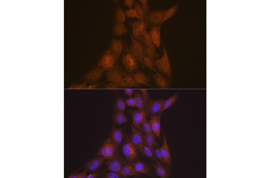 Immunofluorescence - Anti-LIS1 Antibody [ARC2075] (A307979) - Antibodies.com