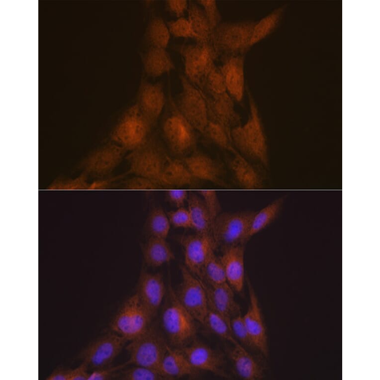 Immunofluorescence - Anti-LIS1 Antibody [ARC2075] (A307979) - Antibodies.com