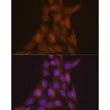 Immunofluorescence - Anti-LIS1 Antibody [ARC2075] (A307979) - Antibodies.com