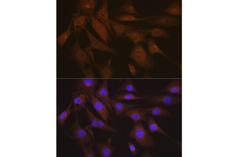 Immunofluorescence - Anti-LIS1 Antibody [ARC2075] (A307979) - Antibodies.com