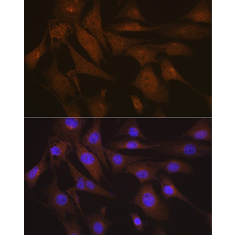 Immunofluorescence - Anti-LIS1 Antibody [ARC2075] (A307979) - Antibodies.com