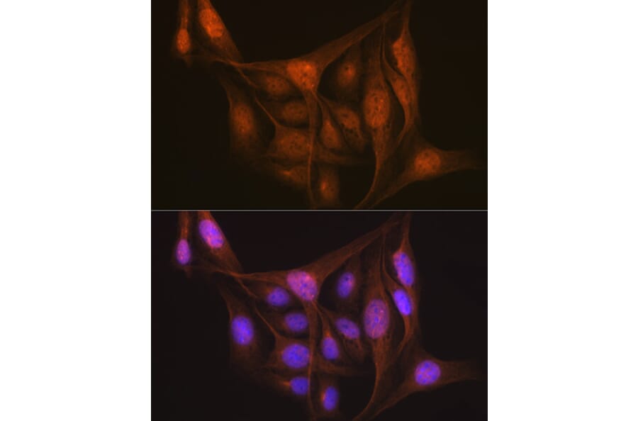 Immunofluorescence - Anti-LIS1 Antibody [ARC2075] (A307979) - Antibodies.com