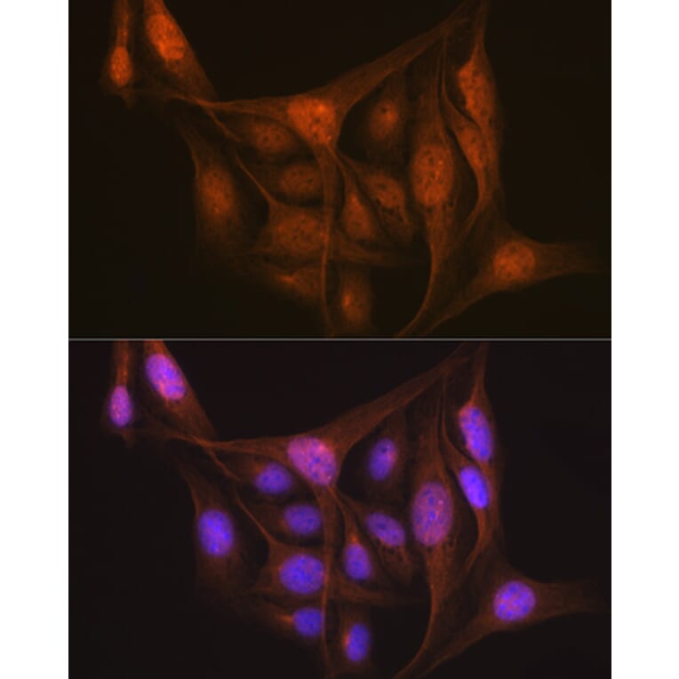 Immunofluorescence - Anti-LIS1 Antibody [ARC2075] (A307979) - Antibodies.com