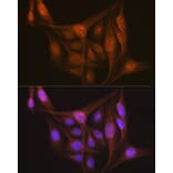 Immunofluorescence - Anti-LIS1 Antibody [ARC2075] (A307979) - Antibodies.com