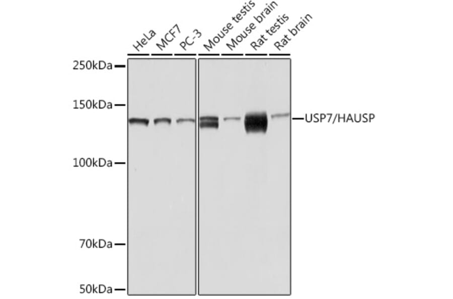 Western Blot - Anti-HAUSP/USP7 Antibody (A307980) - Antibodies.com