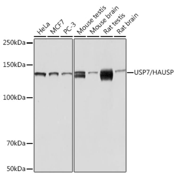 Western Blot - Anti-HAUSP/USP7 Antibody (A307980) - Antibodies.com