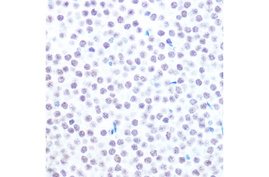 Immunohistochemistry - Anti-HAUSP/USP7 Antibody (A307980) - Antibodies.com