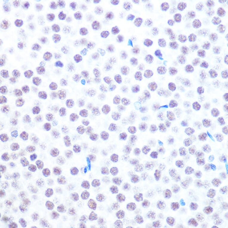 Immunohistochemistry - Anti-HAUSP/USP7 Antibody (A307980) - Antibodies.com