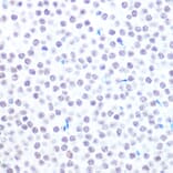 Immunohistochemistry - Anti-HAUSP/USP7 Antibody (A307980) - Antibodies.com