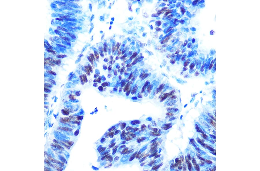 Immunohistochemistry - Anti-HAUSP/USP7 Antibody (A307980) - Antibodies.com