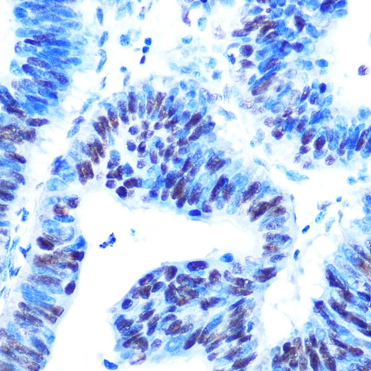Immunohistochemistry - Anti-HAUSP/USP7 Antibody (A307980) - Antibodies.com
