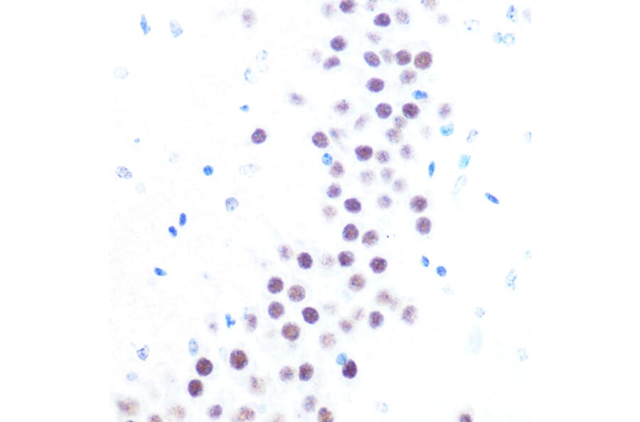 Immunohistochemistry - Anti-HAUSP/USP7 Antibody (A307980) - Antibodies.com