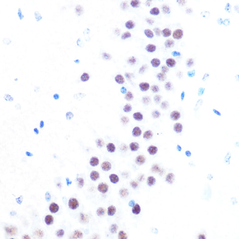 Immunohistochemistry - Anti-HAUSP/USP7 Antibody (A307980) - Antibodies.com