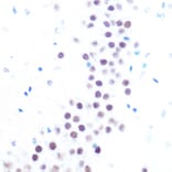 Immunohistochemistry - Anti-HAUSP/USP7 Antibody (A307980) - Antibodies.com