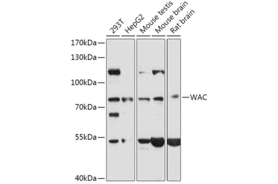 Western Blot - Anti-WAC Antibody (A307981) - Antibodies.com
