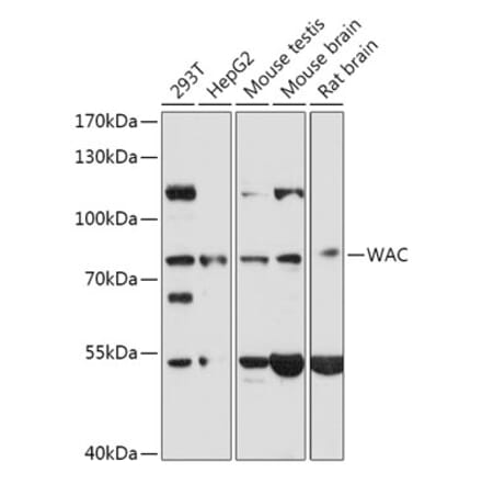 Western Blot - Anti-WAC Antibody (A307981) - Antibodies.com