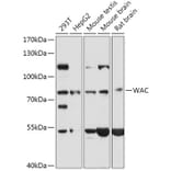 Western Blot - Anti-WAC Antibody (A307981) - Antibodies.com