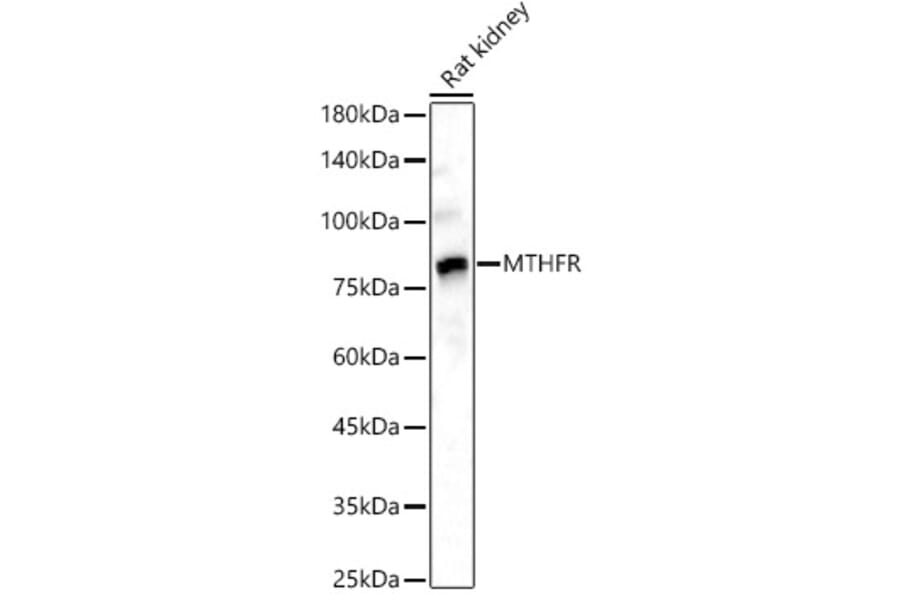 Western Blot - Anti-MTHFR Antibody (A307982) - Antibodies.com