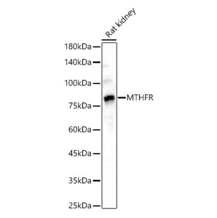 Western Blot - Anti-MTHFR Antibody (A307982) - Antibodies.com