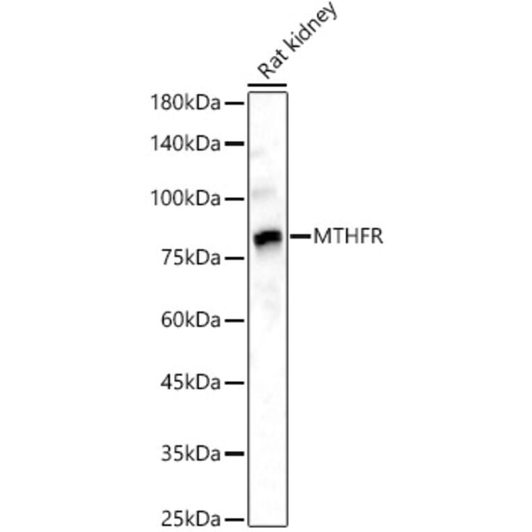 Western Blot - Anti-MTHFR Antibody (A307982) - Antibodies.com