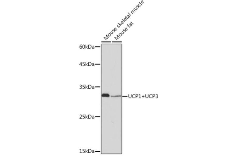 Western Blot - Anti-UCP1 +UCP3 Antibody [ARC2304] (A307983) - Antibodies.com