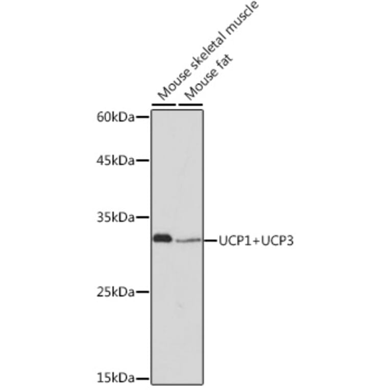 Western Blot - Anti-UCP1 +UCP3 Antibody [ARC2304] (A307983) - Antibodies.com