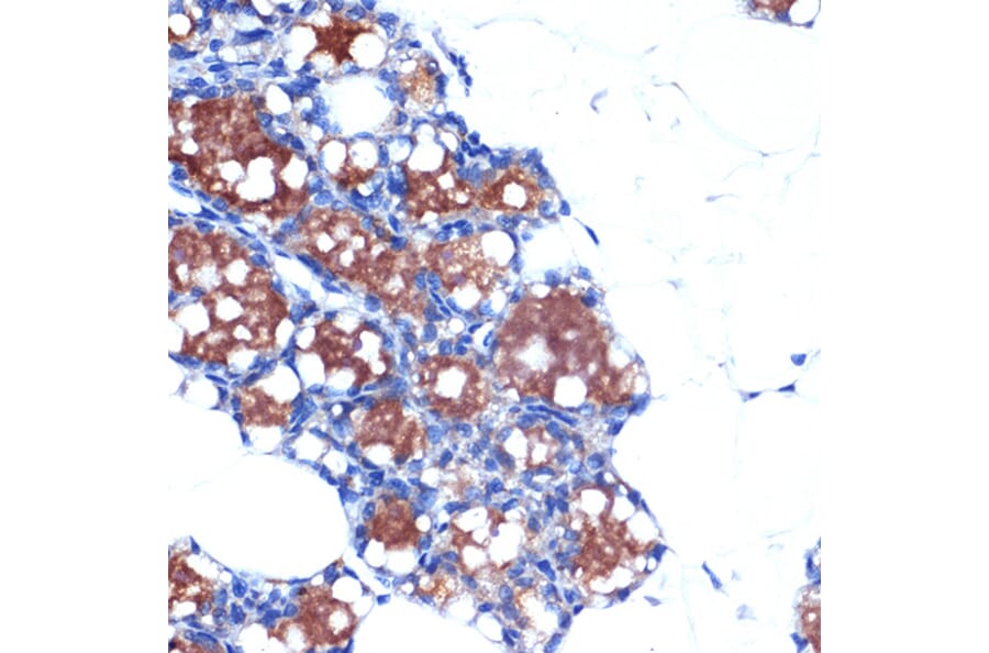 Immunohistochemistry - Anti-UCP1 +UCP3 Antibody [ARC2304] (A307983) - Antibodies.com