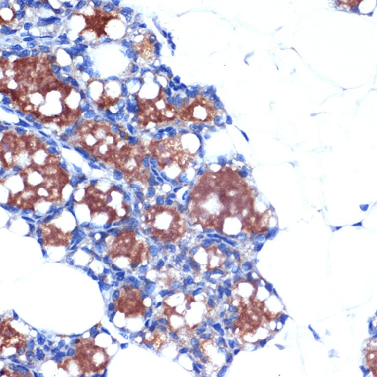 Immunohistochemistry - Anti-UCP1 +UCP3 Antibody [ARC2304] (A307983) - Antibodies.com
