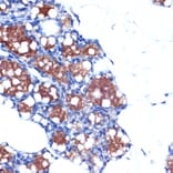 Immunohistochemistry - Anti-UCP1 +UCP3 Antibody [ARC2304] (A307983) - Antibodies.com