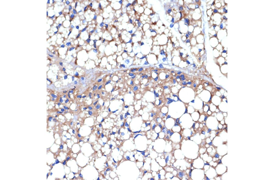 Immunohistochemistry - Anti-UCP1 +UCP3 Antibody [ARC2304] (A307983) - Antibodies.com