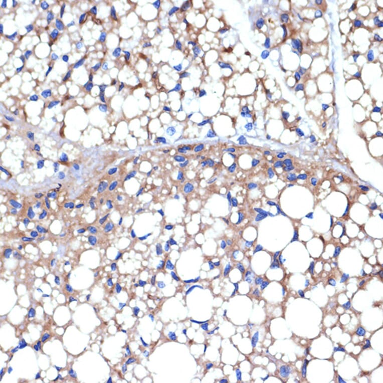 Immunohistochemistry - Anti-UCP1 +UCP3 Antibody [ARC2304] (A307983) - Antibodies.com