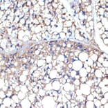 Immunohistochemistry - Anti-UCP1 +UCP3 Antibody [ARC2304] (A307983) - Antibodies.com