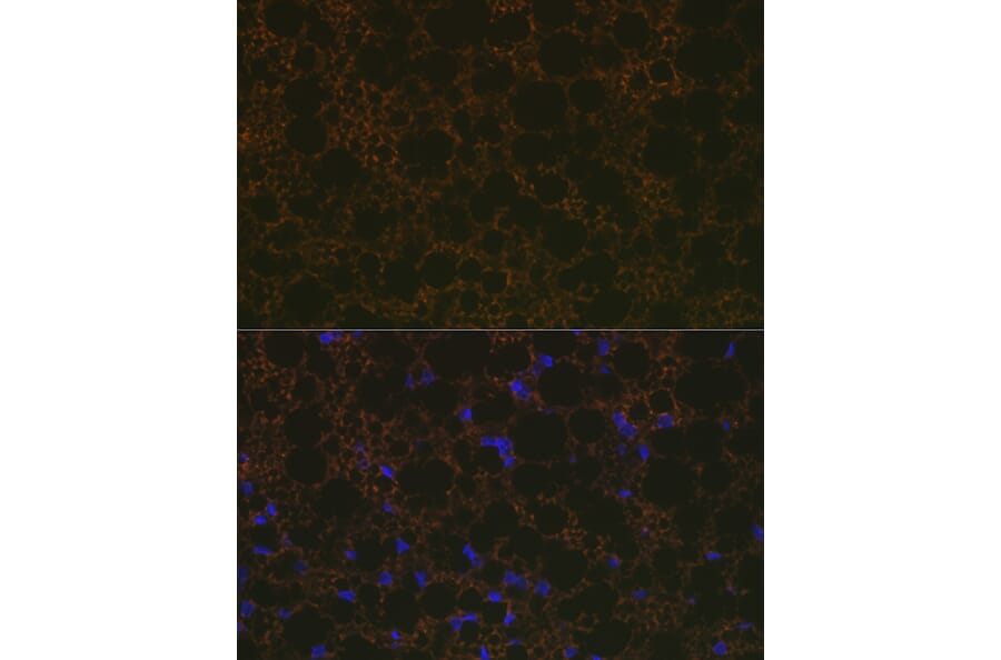 Immunofluorescence - Anti-UCP1 +UCP3 Antibody [ARC2304] (A307983) - Antibodies.com