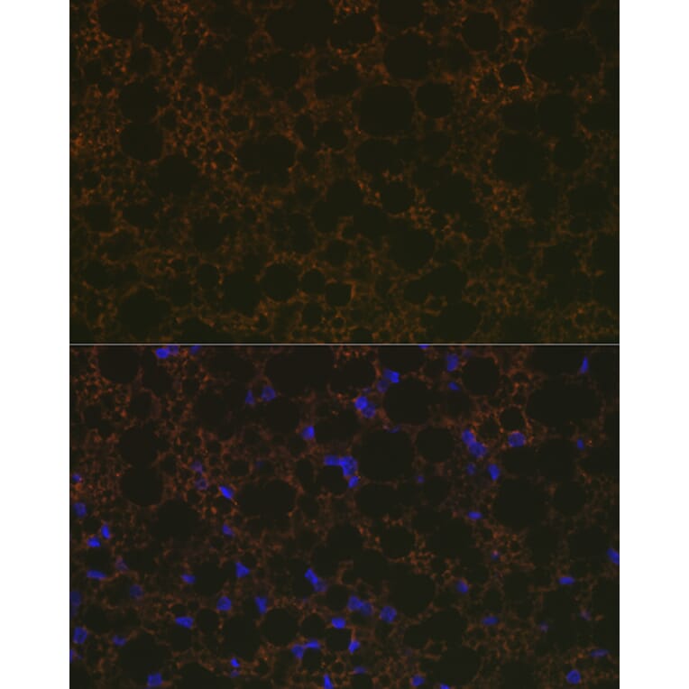 Immunofluorescence - Anti-UCP1 +UCP3 Antibody [ARC2304] (A307983) - Antibodies.com