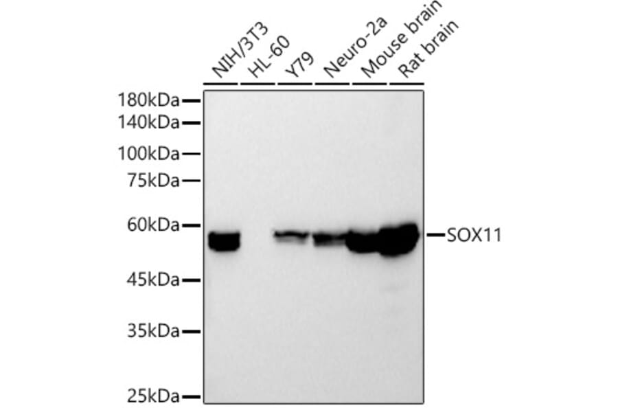 Western Blot - Anti-SOX11 Antibody [ARC54700] (A307984) - Antibodies.com