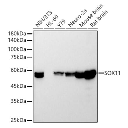 Western Blot - Anti-SOX11 Antibody [ARC54700] (A307984) - Antibodies.com